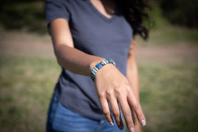 chrysocella and african turquoise